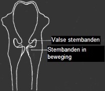 Stembanden uw browser kan dit plaatje niet laden